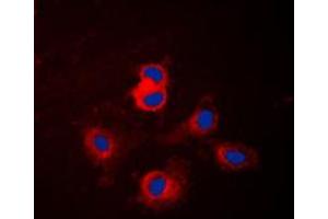 Immunofluorescence (IF) image for anti-Cytochrome P450, Family 17, Subfamily A, Polypeptide 1 (CYP17A1) (Center) antibody (ABIN7295468)