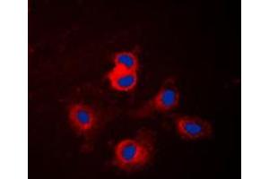 Immunofluorescent analysis of Cytochrome P450 17A1 staining in NIH3T3 cells. (CYP17A1 抗体  (Center))
