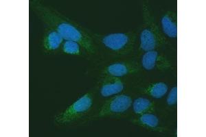 IF analysis of SETD3 using anti-SETD3 antibody (ABIN7600293).