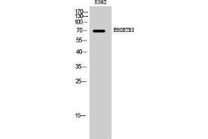 Western Blotting (WB) image for anti-rho-Related BTB Domain Containing 3 (RHOBTB3) (Internal Region) antibody (ABIN3177218) (RHOBTB3 抗体  (Internal Region))