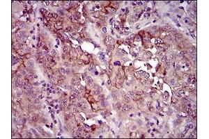 Immunohistochemical analysis of paraffin-embedded endometrium tissues using CD33 mouse mAb with DAB staining. (CD33 抗体  (AA 15-237))
