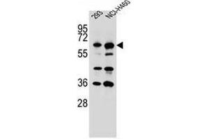 CKAP4 Antibody (C-term) western blot analysis in 293,NCI-H460 cell line lysates (35µg/lane). (CKAP4 抗体  (C-Term))