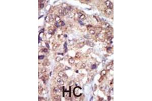 Immunohistochemistry (IHC) image for anti-V-Yes-1 Yamaguchi Sarcoma Viral Related Oncogene Homolog (LYN) antibody (ABIN3003450) (LYN 抗体)