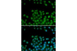 Immunofluorescence (IF) image for anti-Secreted Frizzled-Related Protein 2 (SFRP2) antibody (ABIN1876571) (SFRP2 抗体)