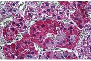 Human Adrenal: Formalin-Fixed, Paraffin-Embedded (FFPE) (CAMKK1 抗体  (AA 1-521))