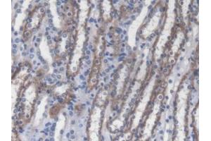 IHC-P analysis of Mouse Kidney Tissue, with DAB staining. (RIPK2 抗体  (AA 1-294))