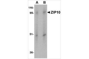 Western blot analysis of ZIP10 in human spleen tissue lysate with ZIP10 antibody at (A) 1 and (B) 2 μg/ml. (SLC39A10 抗体  (Center))