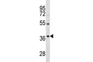 ORAI3 antibody western blot analysis in HepG2 lysate. (ORAI3 抗体  (AA 1-30))