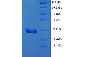 SDS-PAGE (SDS) image for Lymphocyte Antigen 75 (LY75) (AA 28-211), (partial) protein (His tag) (ABIN5709885)