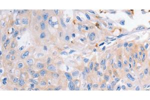 Immunohistochemistry (Paraffin-embedded Sections) (IHC (p)) image for anti-Potassium Voltage-Gated Channel, Shaker-Related Subfamily, Member 1 (KCNA1) antibody (ABIN7242236)