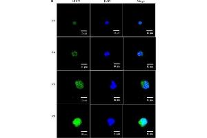 Stimulatory effect of exogenous NAD+ on MUC2 expression in LS 174T goblet cells.