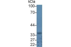 Western Blot; Sample: Rat Kidney lysate; Primary Ab: 5µg/ml Rabbit Anti-Human GDF3 Antibody Second Ab: 0. (GDF3 抗体  (AA 251-364))
