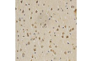 Immunohistochemistry of paraffin-embedded mouse brain using HDAC6 antibody (ABIN5997884) at dilution of 1/100 (40x lens). (HDAC6 抗体)
