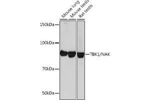 Western blot analysis of extracts of various cell lines, using TBK1/NAK Rabbit mAb (ABIN7270723) at 1:1000 dilution. (TBK1 抗体)