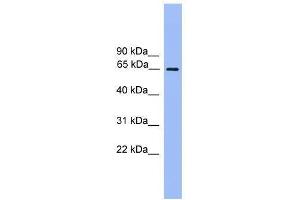UBQLN2 antibody used at 0. (Ubiquilin 2 抗体  (N-Term))
