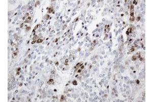 Image no. 3 for anti-Proliferating Cell Nuclear Antigen (PCNA) antibody (ABIN1500061)