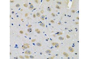 Immunohistochemistry of paraffin-embedded Rat brain using TXNDC5 Polyclonal Antibody at dilution of 1:100 (40x lens). (TXNDC5 抗体)
