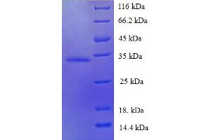 SDS-PAGE (SDS) image for Trefoil Factor 1 (TFF1) (AA 25-84) protein (GST tag) (ABIN5710476)