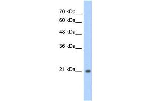 WB Suggested Anti-TSHR Antibody Titration:  1. (TSH receptor 抗体  (N-Term))