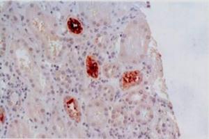 Immunohistochemistry staining of kidney allograft biopsy (paraffin-embedded sections) with anti-human HLA-G (MEM-G/2). (HLAG 抗体)