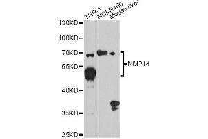 Western blot analysis of extracts of various cell lines, using MMP14 antibody. (MMP14 抗体)