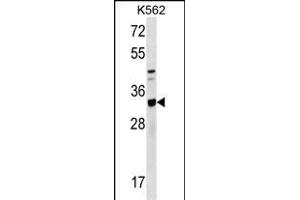 TIPRL Antibody (C-term) (ABIN1536814 and ABIN2849644) western blot analysis in K562 cell line lysates (35 μg/lane). (TIPRL 抗体  (C-Term))