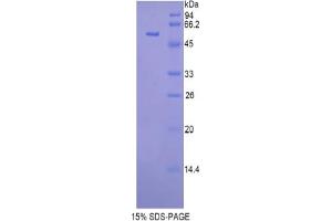 SDS-PAGE analysis of Mouse Glucosidase beta , Acid Protein. (GBA 蛋白)
