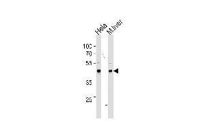 TBX6 Antibody (Center ) (ABIN655621 and ABIN2845101) western blot analysis in Hela cell line and mouse liver tissue lysates (35 μg/lane). (T-Box 6 抗体  (AA 143-172))