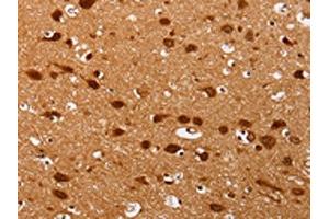 The image on the left is immunohistochemistry of paraffin-embedded Human brain tissue using ABIN7130740(PSMD3 Antibody) at dilution 1/25, on the right is treated with fusion protein. (PSMD3 抗体)