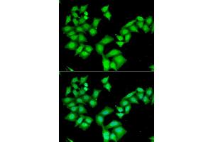Immunofluorescence analysis of HeLa cells using AAAS antibody (ABIN5973827). (Adracalin 抗体)