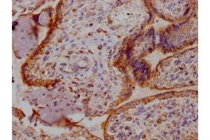 IHC image of ABIN7127339 diluted at 1:100 and staining in paraffin-embedded human placenta tissue performed on a Leica BondTM system.