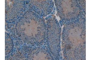 IHC-P analysis of Mouse Testis Tissue, with DAB staining. (RELB 抗体  (AA 176-436))