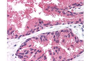 Anti-LDB1 antibody IHC of human prostate. (LIM Domain Binding 1 Protein 抗体  (AA 303-352))