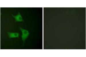 Immunofluorescence analysis of HeLa cells, using p15 INK Antibody. (CDKN2B 抗体  (AA 89-138))