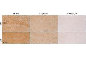 Noxa immunostaining in seizure-damaged hippocampi from wt and Noxa-deficient mice. (NOXA 抗体)