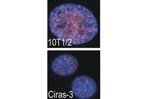 Indirect IF analysis showed that RSKB is localized in the nucleus of parental (10T1/2) and oncogene-transformed (Ciras-3) mouse fibroblasts (MSK2 抗体  (AA 322-354))
