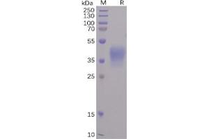 SARS-CoV-2 Spike-Membrane Recombinant Fusion Protein, His Tag on SDS-PAGE under reducing condition.