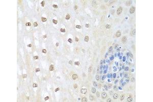 Immunohistochemistry of paraffin-embedded Human esophagus using NEDD8 Polyclonal Antibody at dilution of 1:100 (40x lens). (NEDD8 抗体)