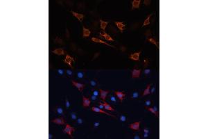 Immunofluorescence analysis of C6 cells using HSP70/HSP Polyclonal Antibody (2948) at dilution of 1:100 (40x lens). (HSP70 1A 抗体  (AA 500-600))