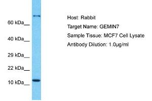 Host: Rabbit Target Name: GEMIN7 Sample Type: MCF7 Whole Cell lysates Antibody Dilution: 1. (GEMIN7 抗体  (N-Term))