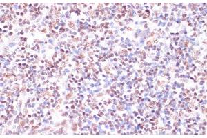 Immunohistochemistry of paraffin-embedded Human lymph node using CREB1 Polyclonal Antibody at dilution of 1:100 (40x lens). (CREB1 抗体)