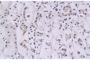 Immunohistochemistry (IHC) image for anti-Interferon gamma (IFNG) (AA 81-166) antibody (ABIN669141) (Interferon gamma 抗体  (AA 81-166))