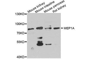 Western blot analysis of extract of various cells, using MEP1A antibody. (MEP1A 抗体)