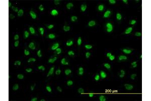 Immunofluorescence of monoclonal antibody to SNAI2 on HeLa cell. (SLUG 抗体  (AA 97-169))