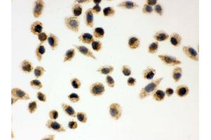 IHC analysis of Peroxiredoxin 3 using anti-Peroxiredoxin 3 antibody . (Peroxiredoxin 3 抗体  (AA 110-256))