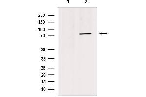 Western blot analysis of extracts from HepG2, using TRI18 Antibody. (MID1 抗体  (N-Term))
