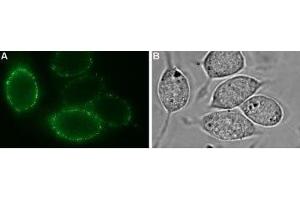 Immunocytochemistry (ICC) image for anti-Potassium Inwardly-Rectifying Channel, Subfamily J, Member 2 (KCNJ2) (AA 112-125), (Extracellular) antibody (ABIN7043481)
