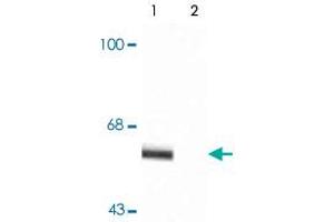 Western blot of rat cortex lysate showing specific immunolabeling of the ~60k - ~62k Syt1 phosphorylated at Thr202 (Control). (SYT1 抗体  (pThr202))