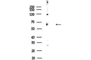 Western blot analysis of lysates from Rat testis, using ZNF397 Antibody at 1/1000 dilution.