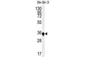 TP53INP1 Antibody (N-term) western blot analysis in SK-BR-3 cell line lysates (35 µg/lane). (TP53INP1 抗体  (N-Term))